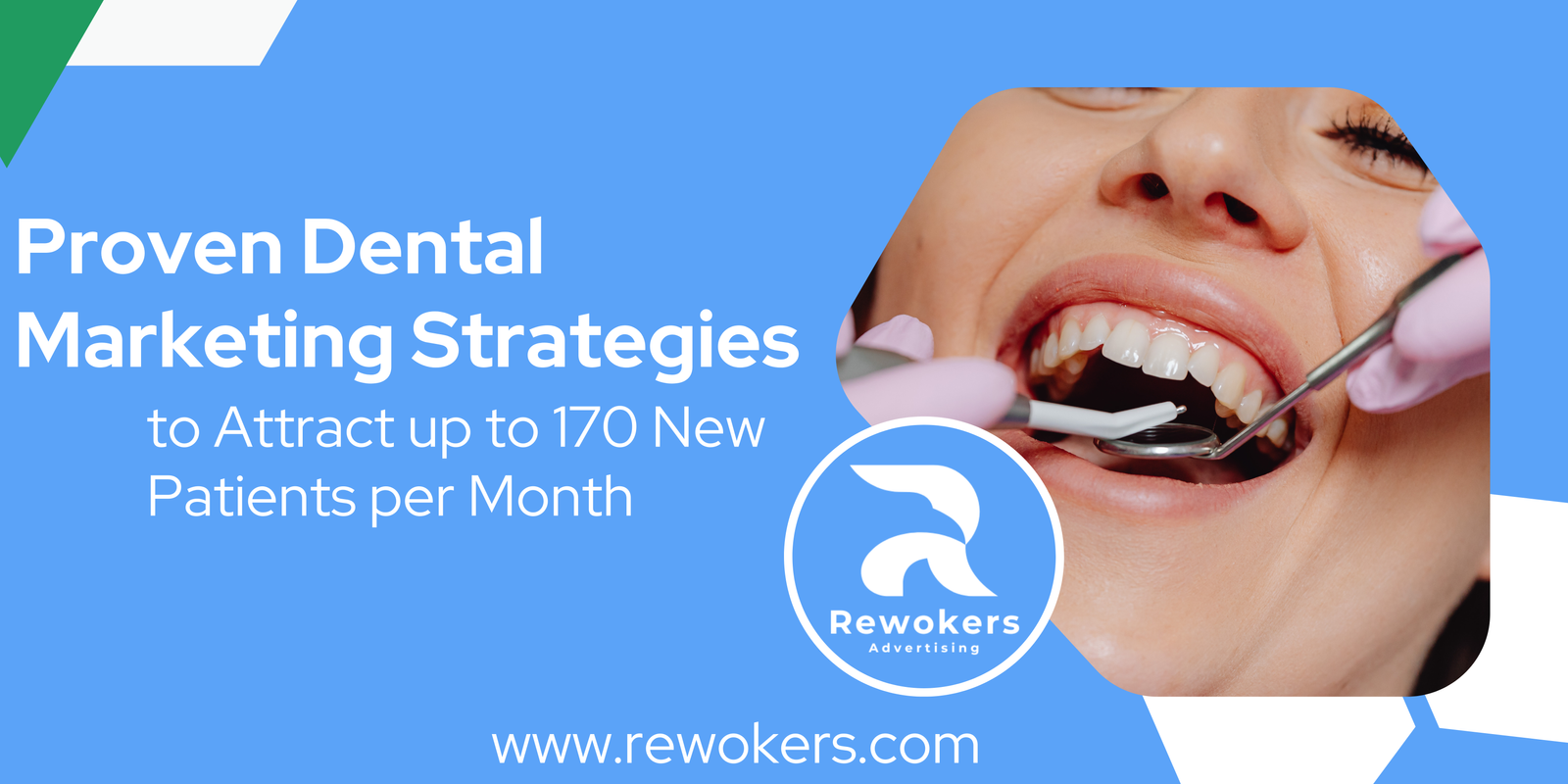 7 Proven Dental Marketing Strategies to Attract up to 170 New Patients per Month